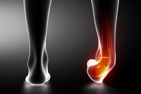 Ankle Sprain: Ouch! But Don't Freak Out - Cover Image
